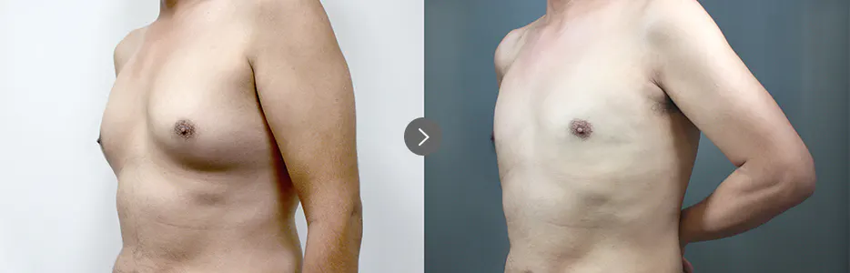 BEFORE&AFTER 5