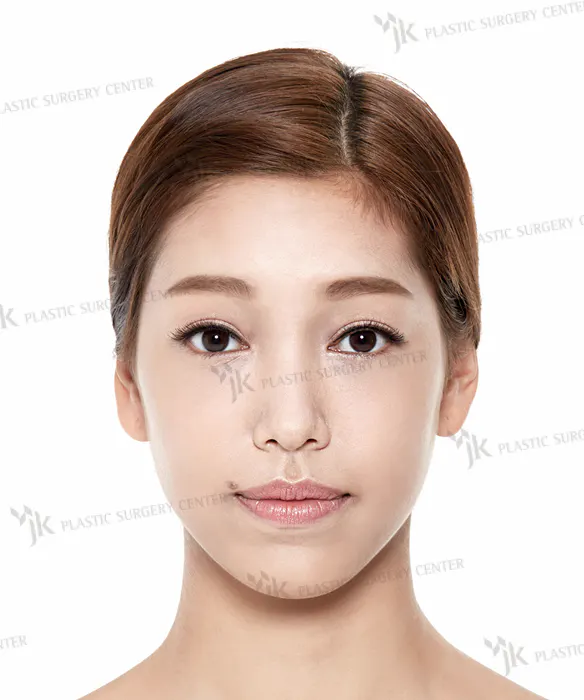 BEFORE&AFTER 5