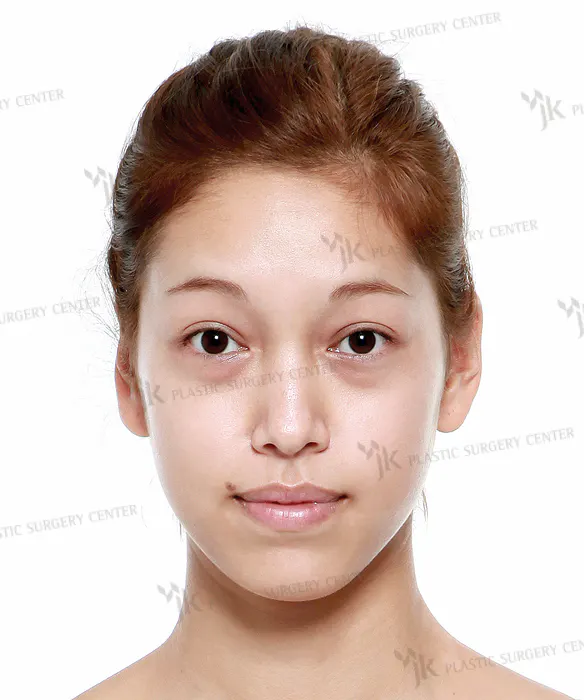 BEFORE&AFTER 2