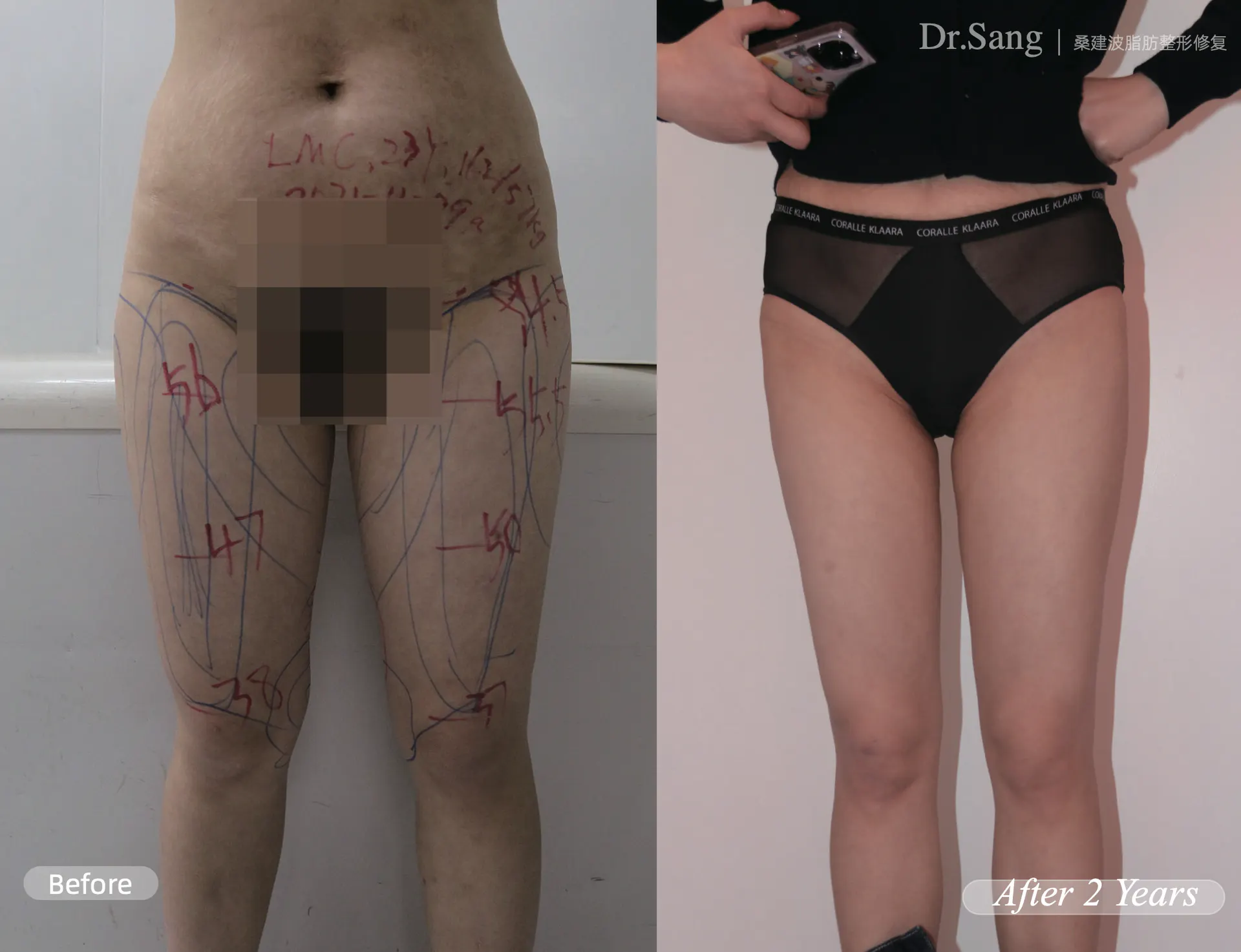 BEFORE&AFTER 8