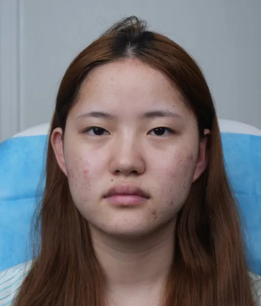 BEFORE&AFTER 7