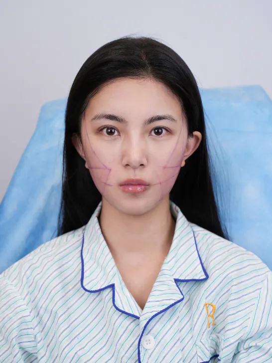 这些是曾在 REAL 5
