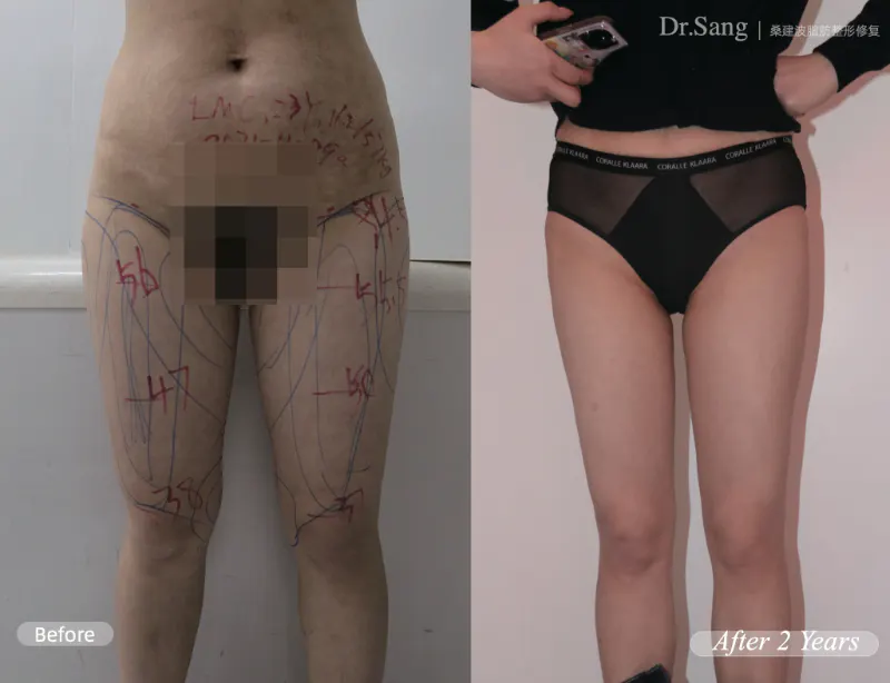 BEFORE&AFTER 7