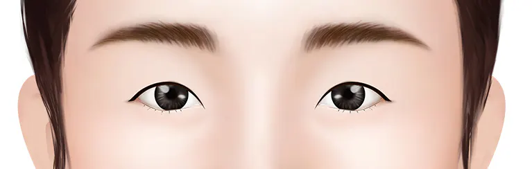 成功的手术 =