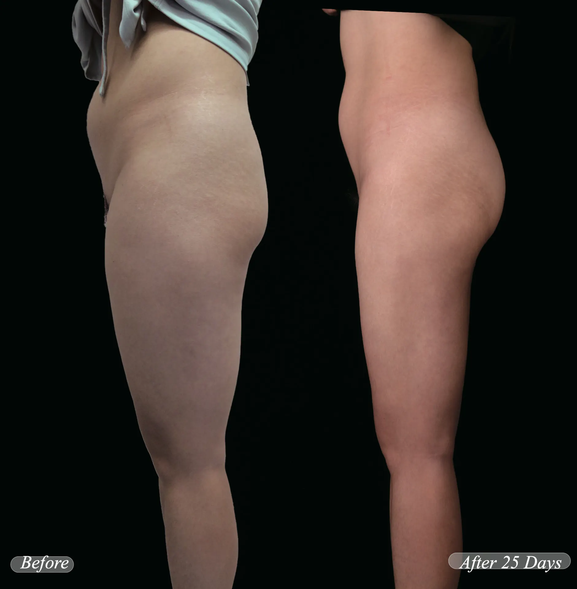 BEFORE&AFTER 5
