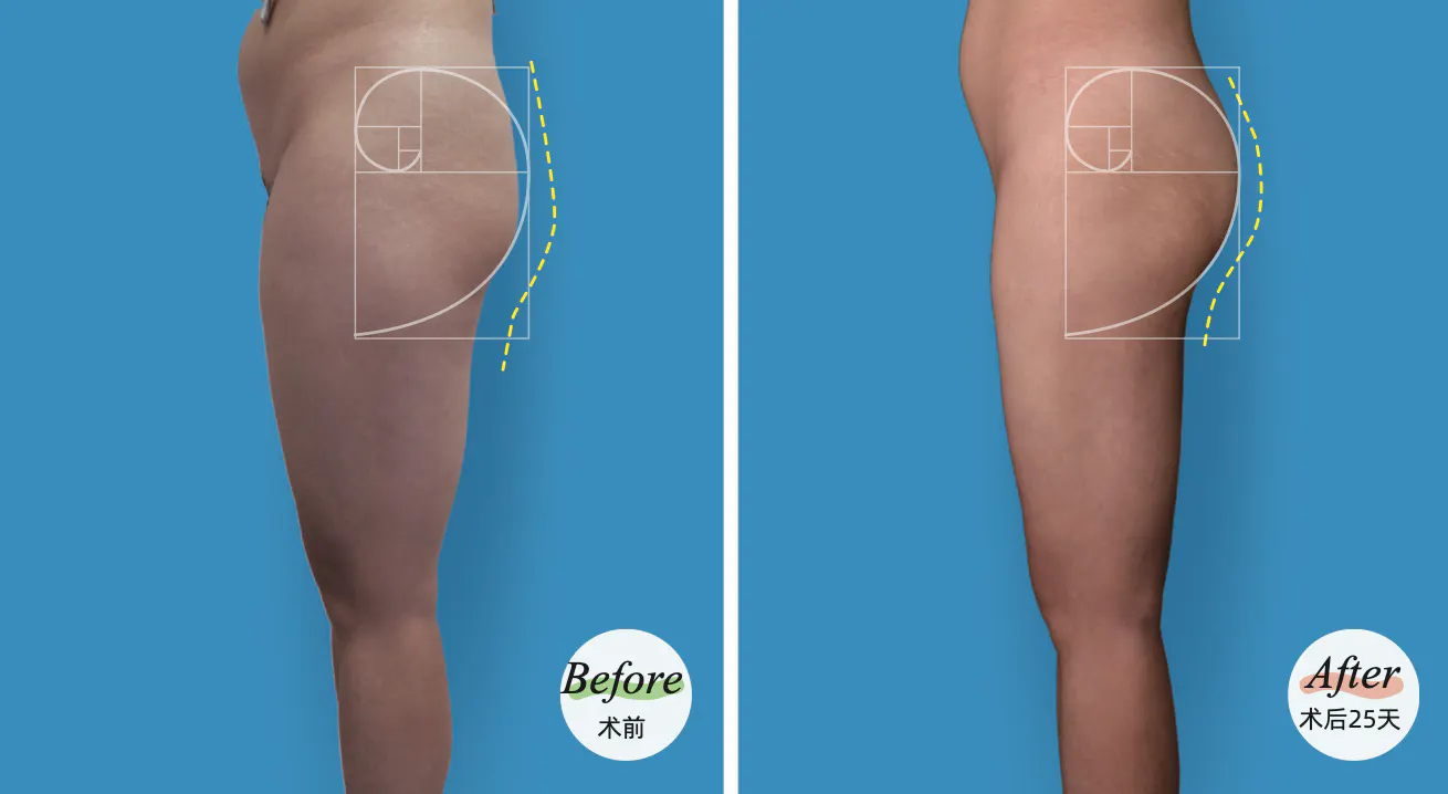 BEFORE&AFTER 2