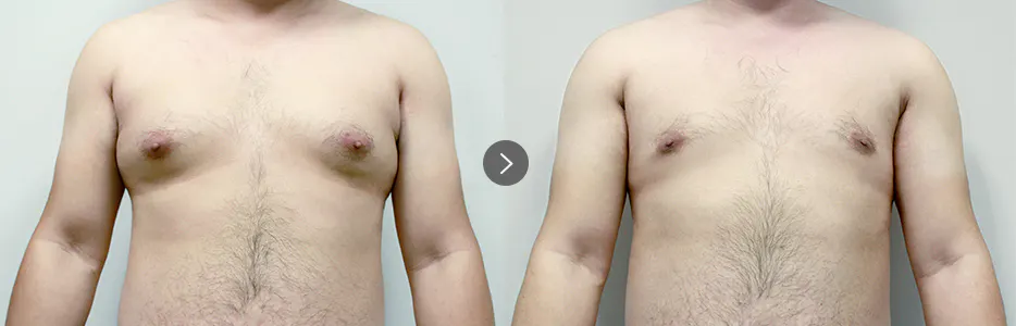 BEFORE&AFTER 1