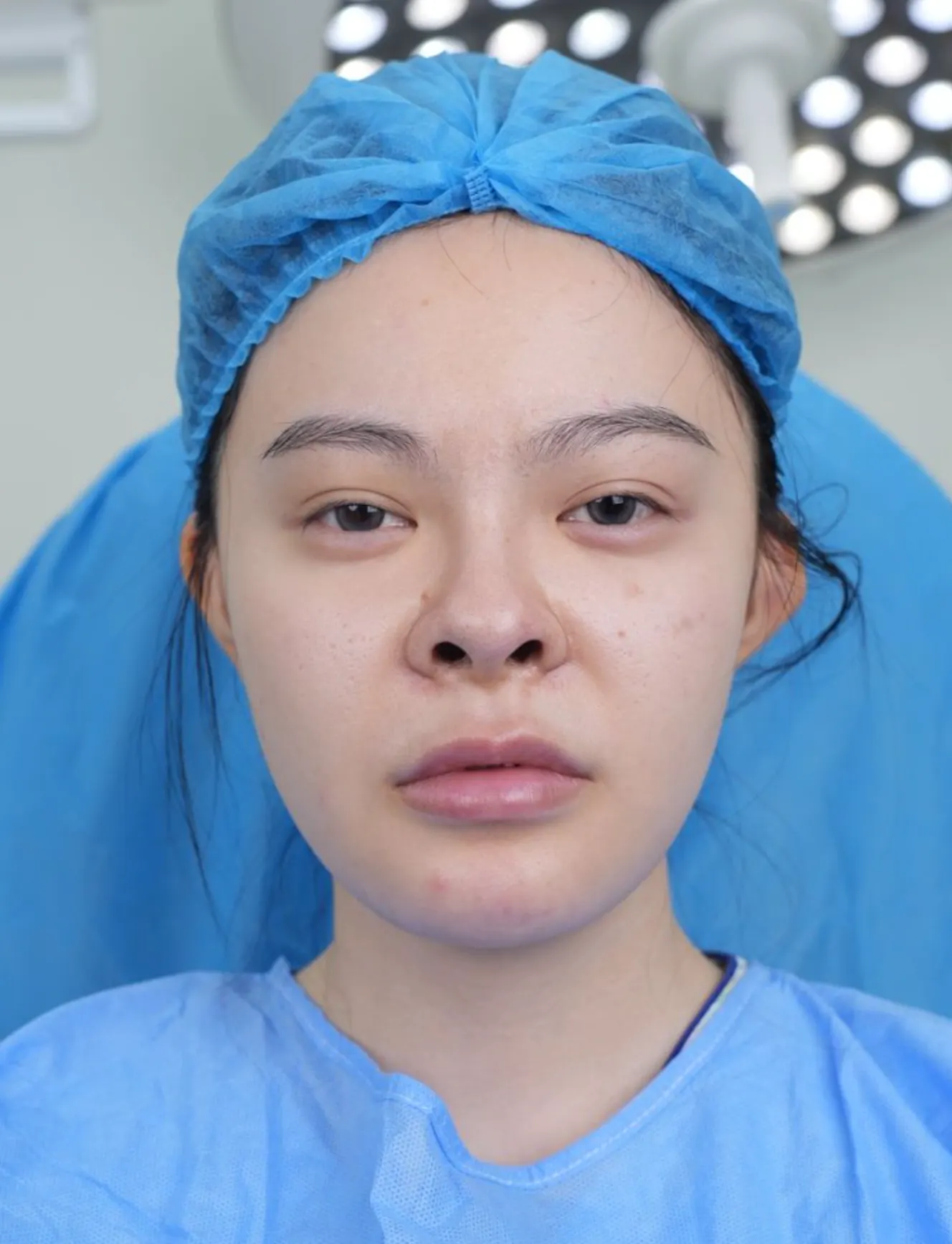 前后照片