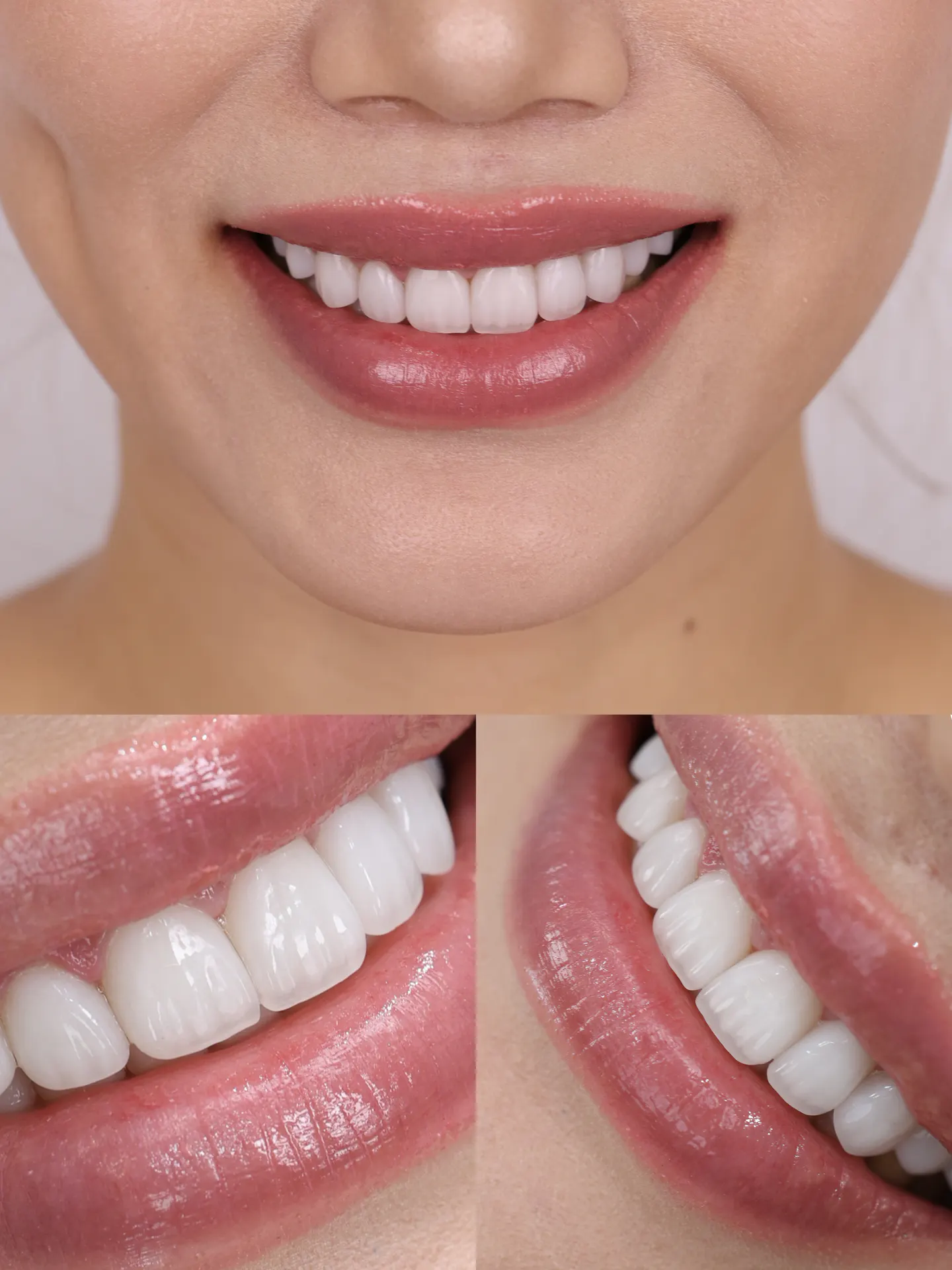 BEFORE&AFTER 8