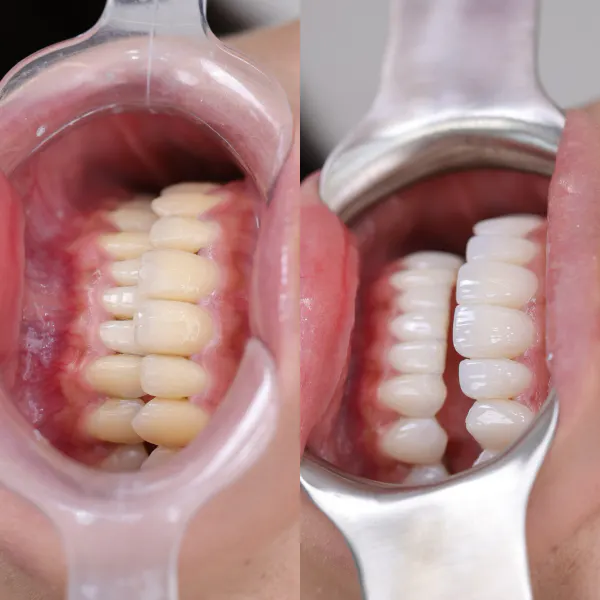 BEFORE&AFTER 9