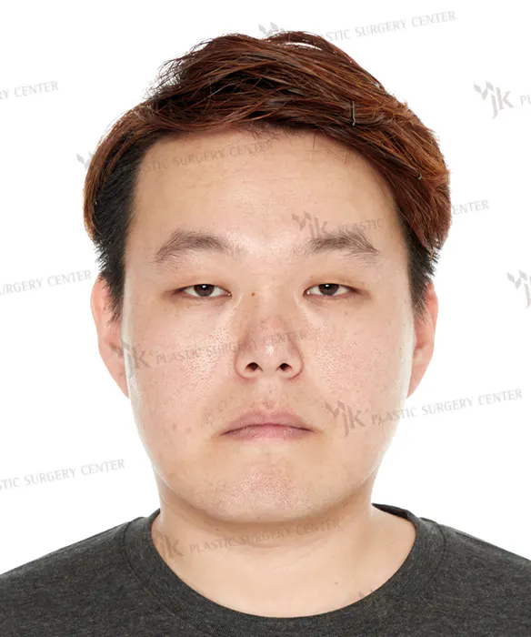 BEFORE&AFTER 8
