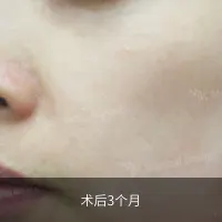 前后对比 9