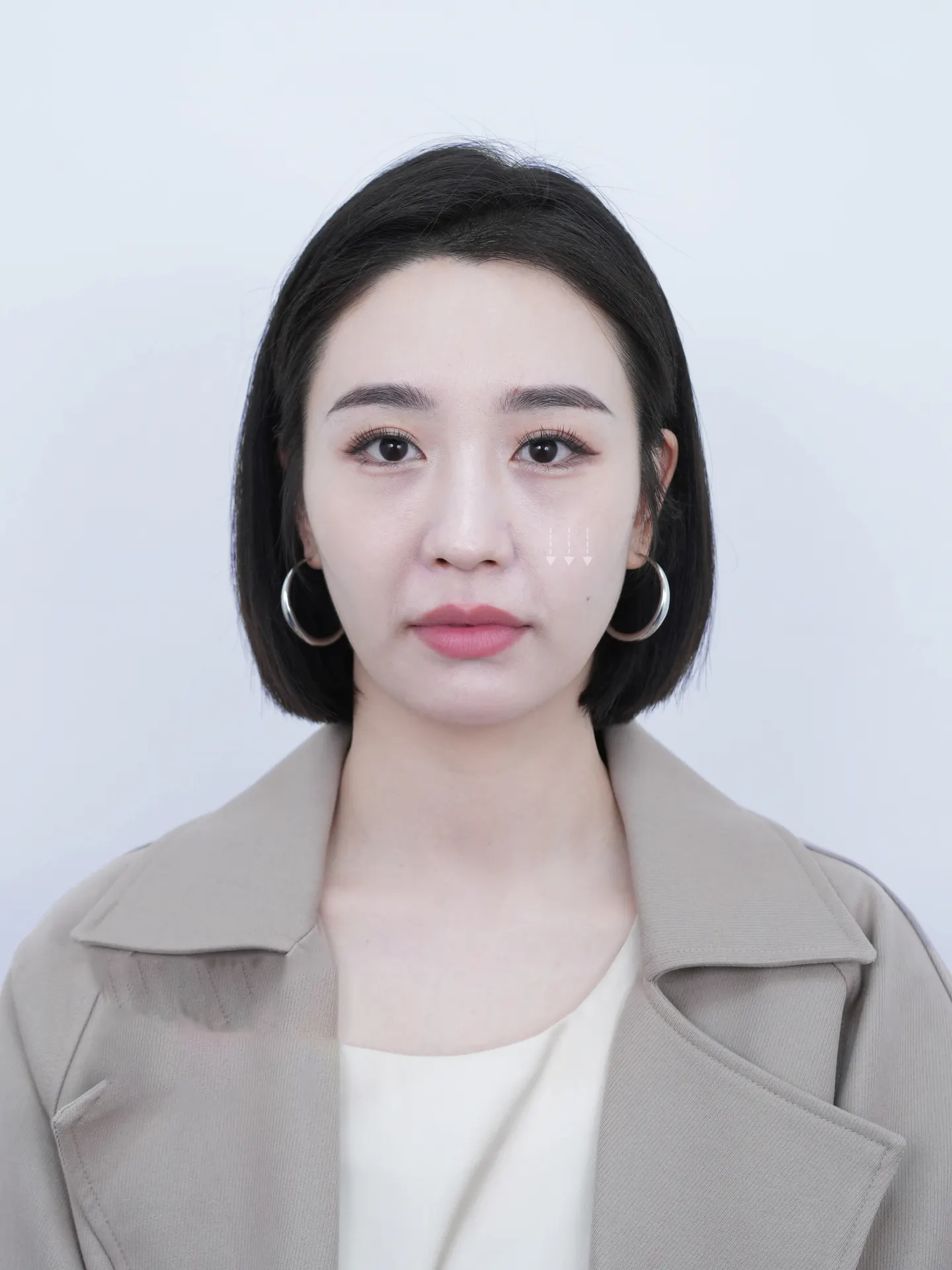 深层拉皮