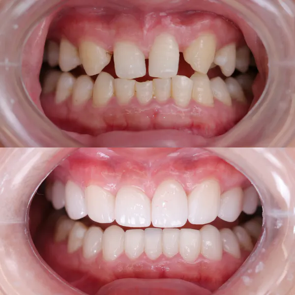 BEFORE&AFTER 3