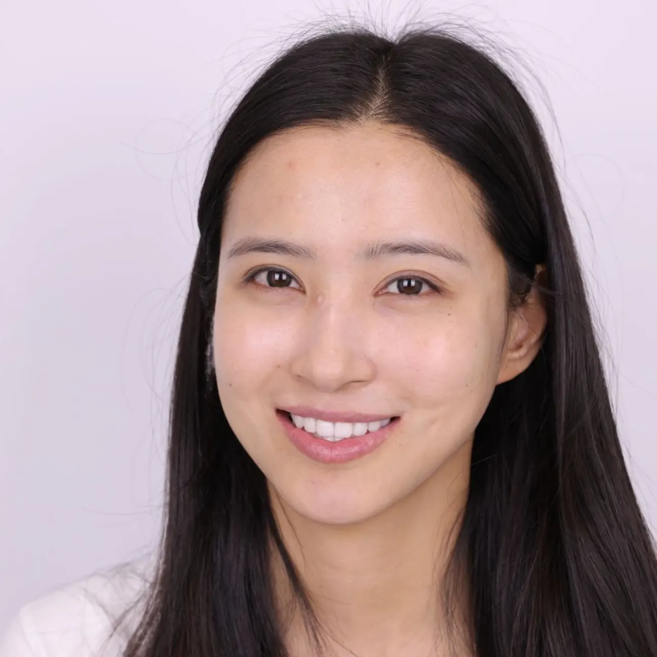 恒温皓齿美白疗程后记