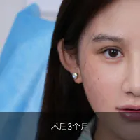 前后对比 4