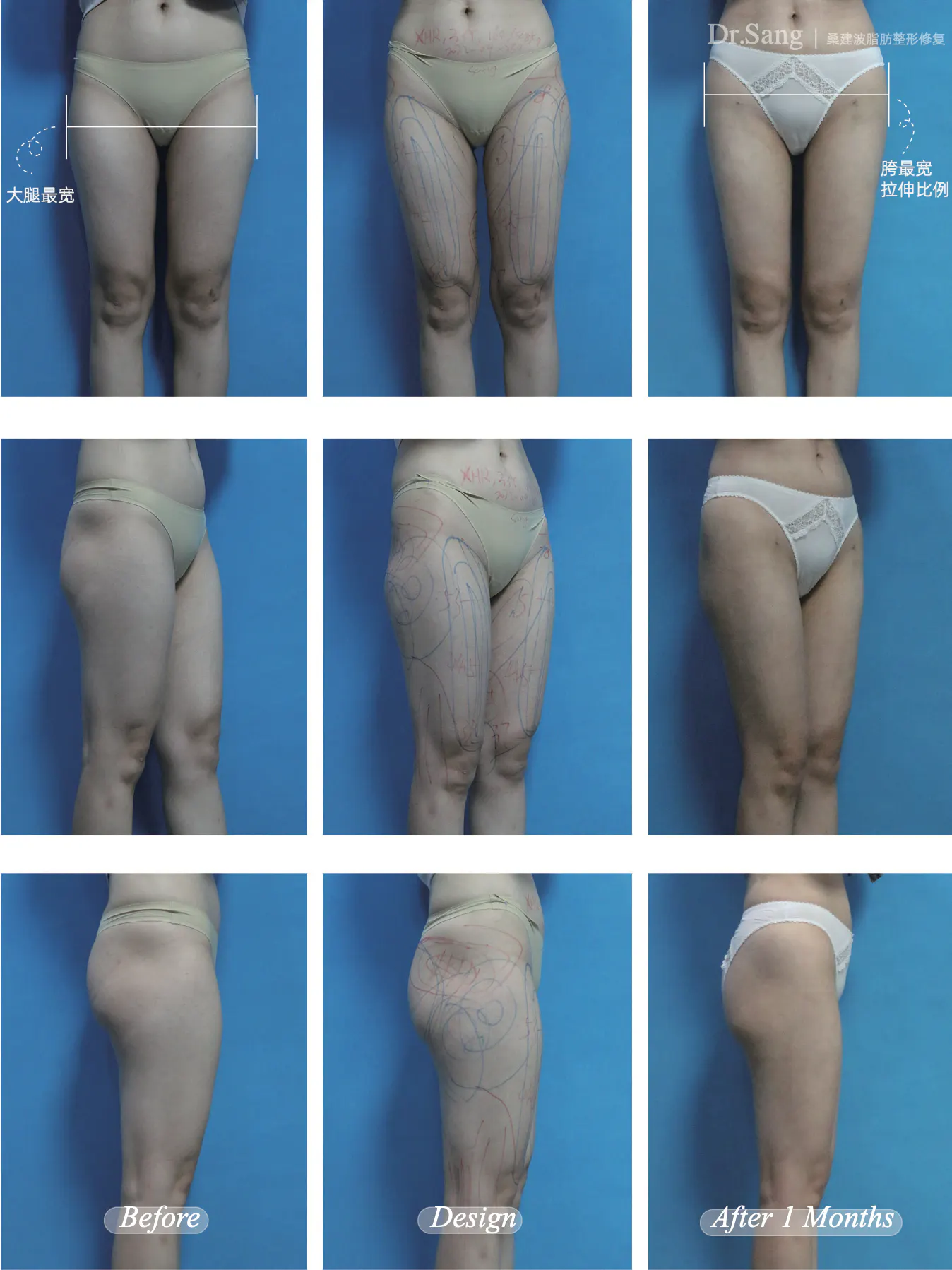 BEFORE&AFTER 10