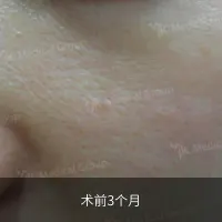 前后对比 3