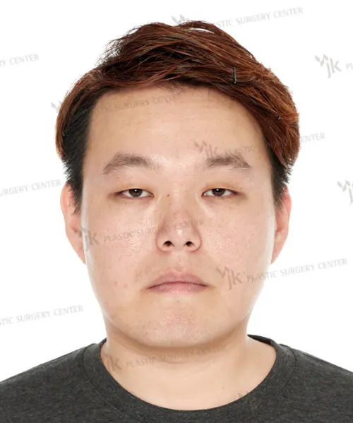 BEFORE&AFTER 5