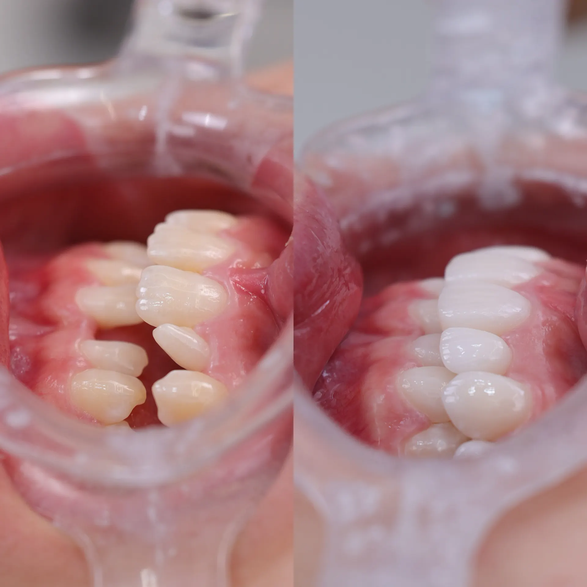 BEFORE&AFTER 2