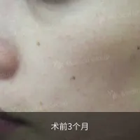 前后对比 7