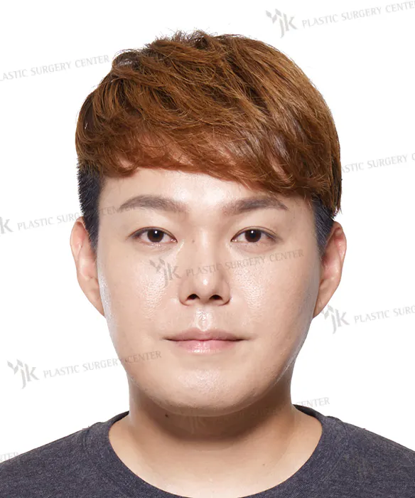 BEFORE&AFTER 11