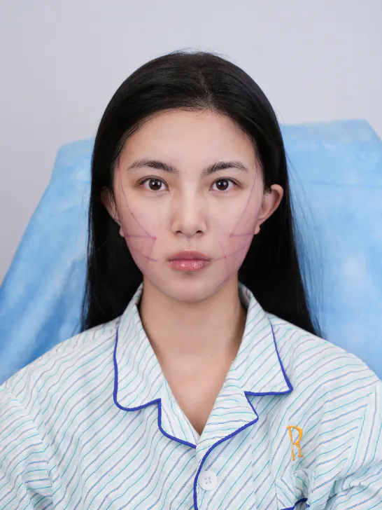 这些是曾在 REAL 5