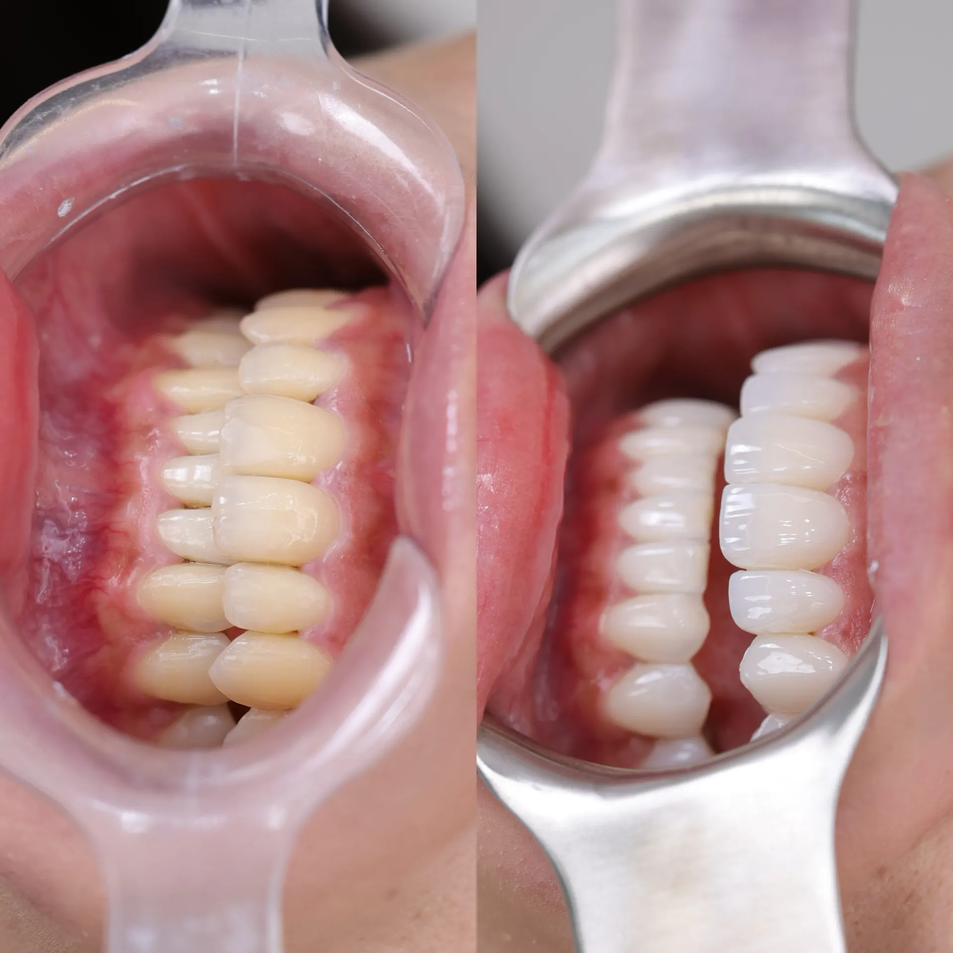 BEFORE&AFTER 10