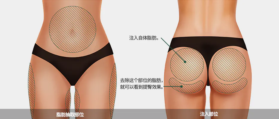 考虑臀部线条与身体曲线的谐调