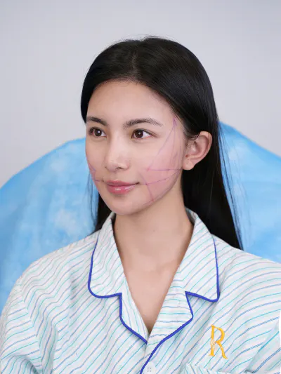 前后对比 7