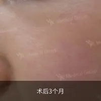 前后对比 5