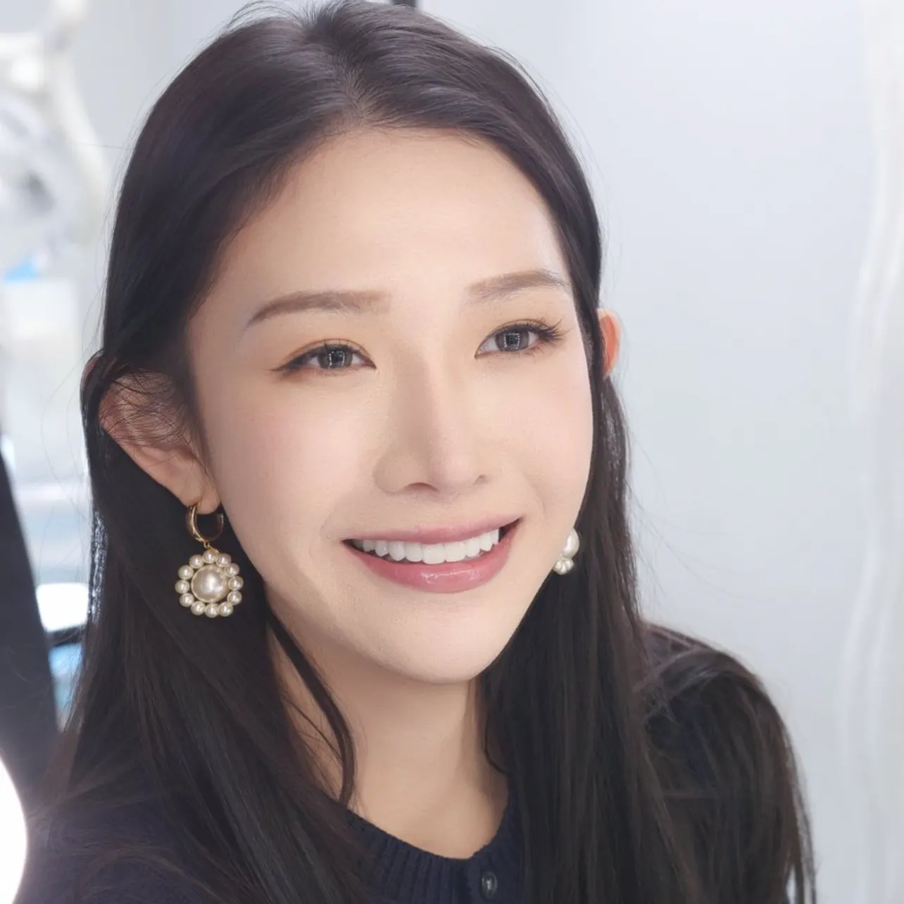 数字化微创瓷贴面术后记