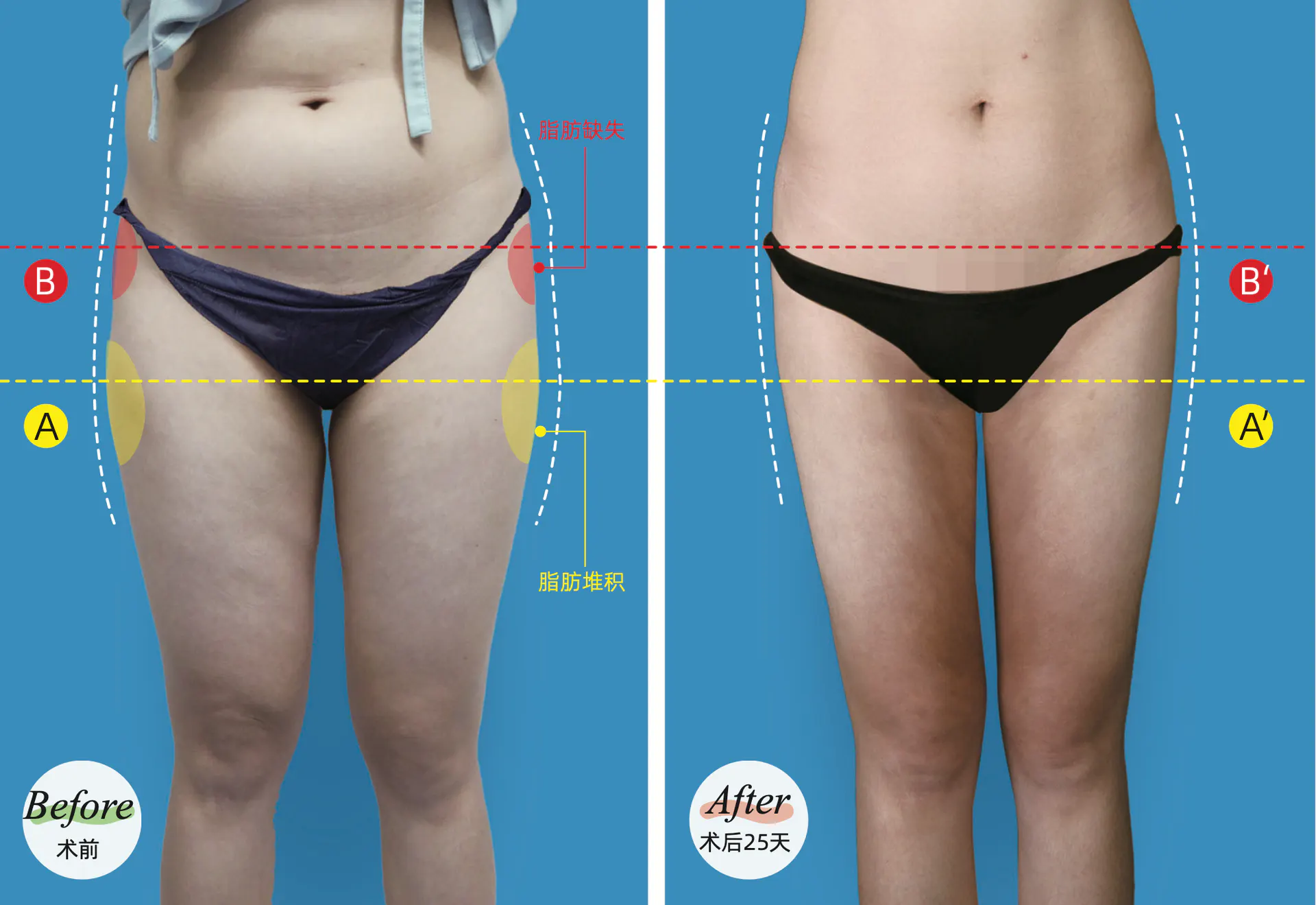 BEFORE&AFTER 4