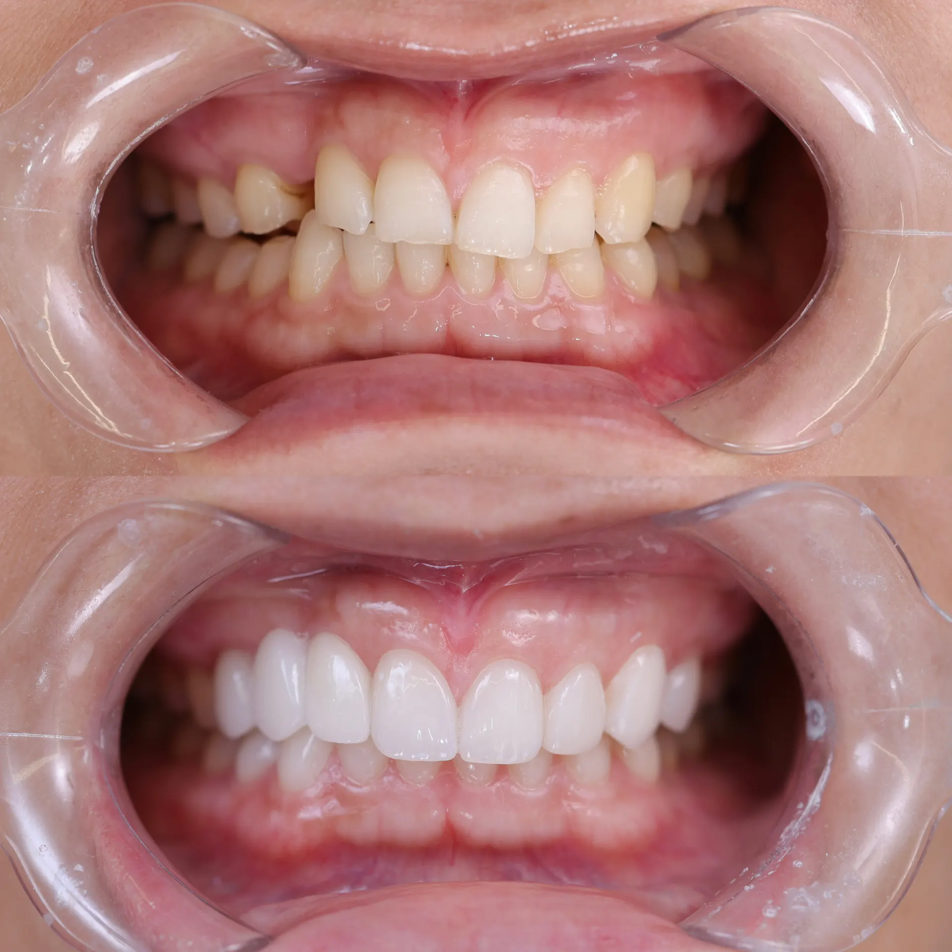 BEFORE&AFTER 8