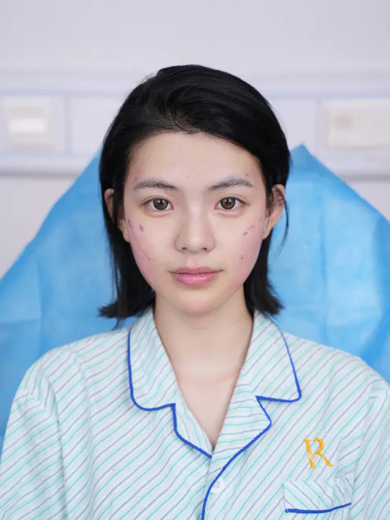 这些是曾在 REAL 1