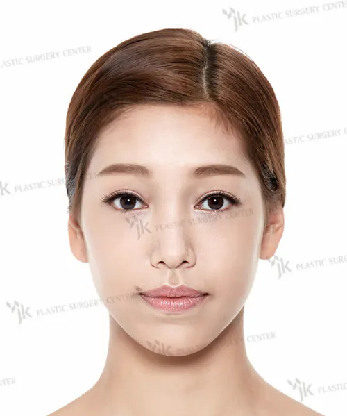 BEFORE&AFTER 3