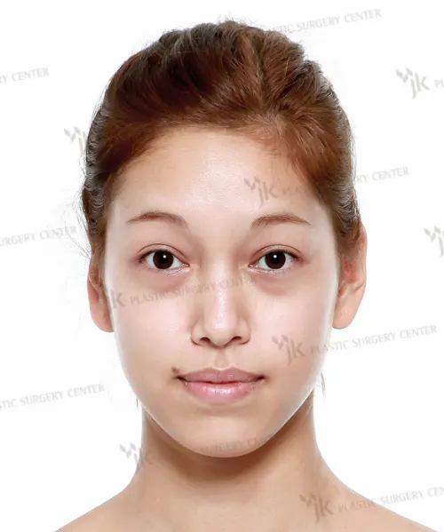 BEFORE&AFTER 1