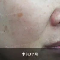 前后对比 11