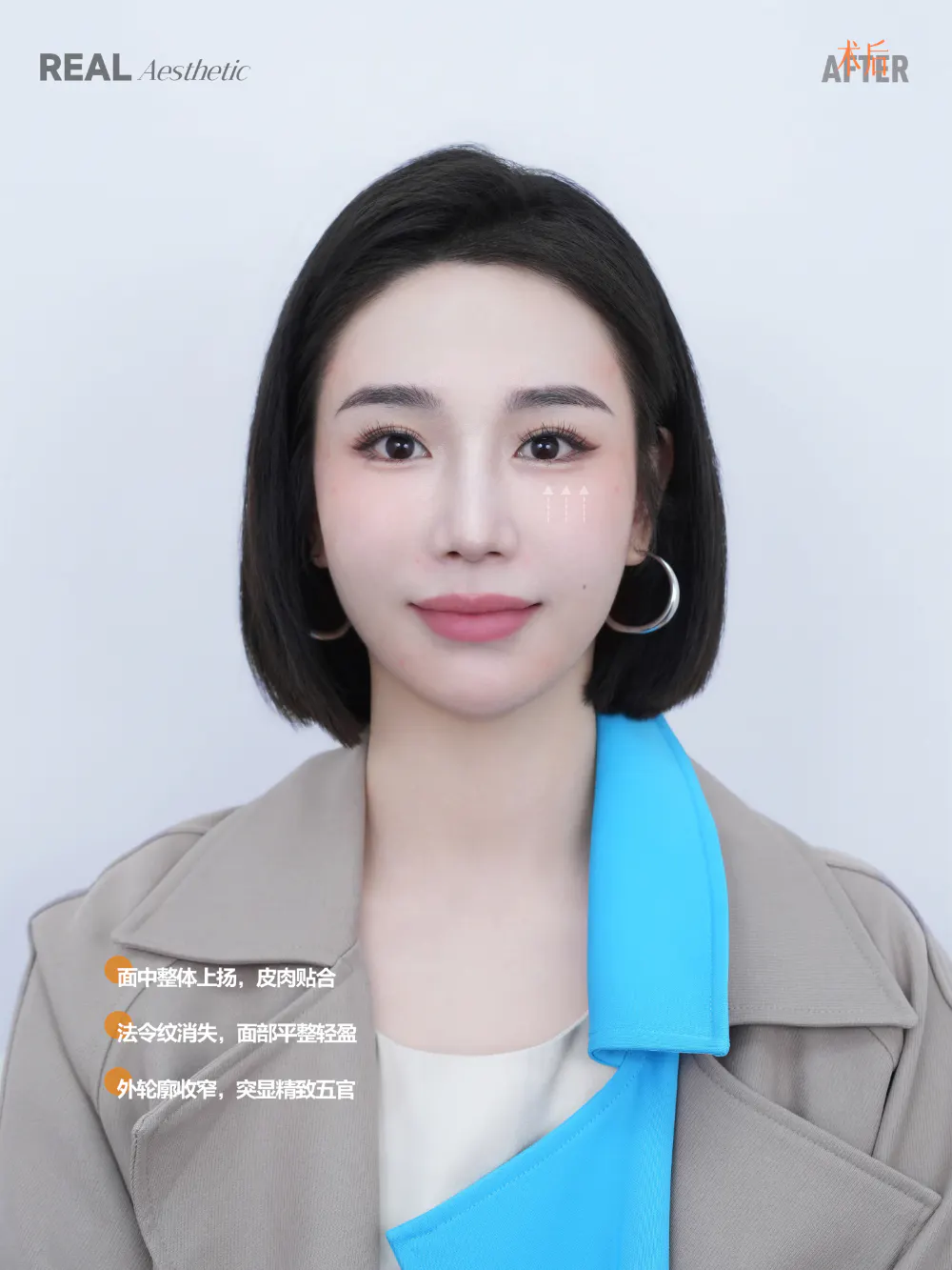 整体美容 2