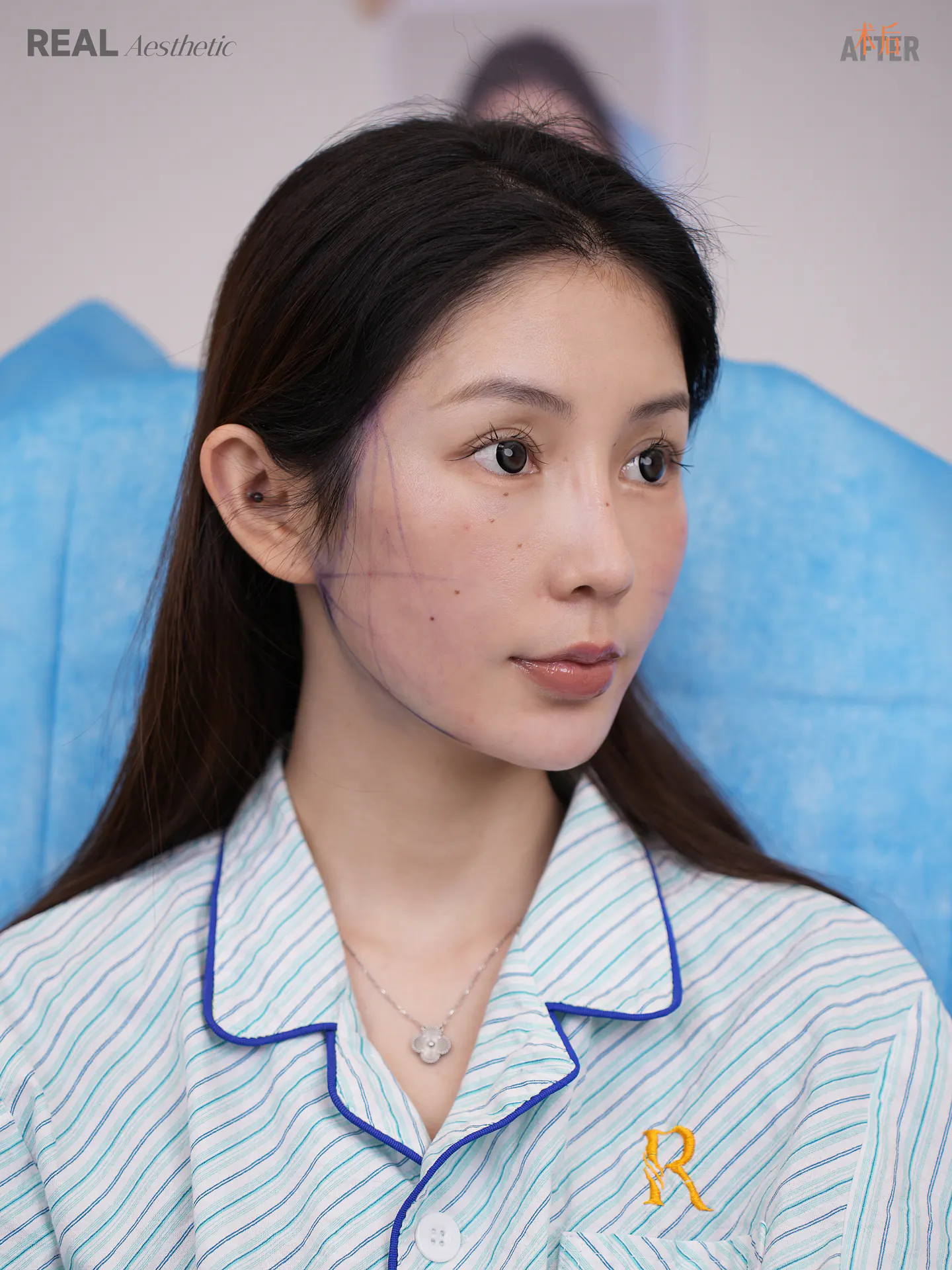 小巧纤细的脸型 1