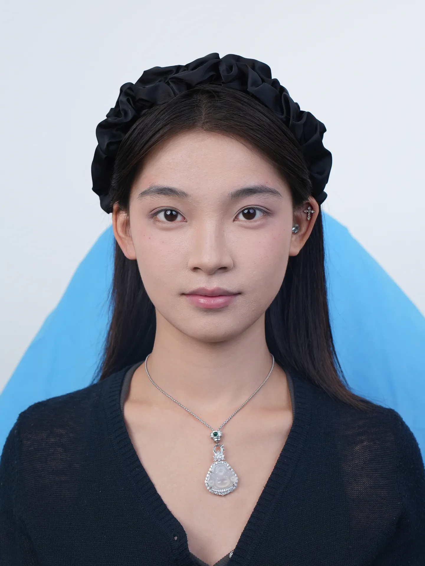 眼部整形前后照片