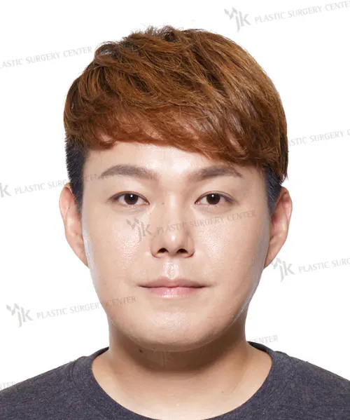 BEFORE&AFTER 7