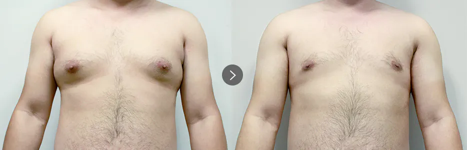 BEFORE&AFTER 2