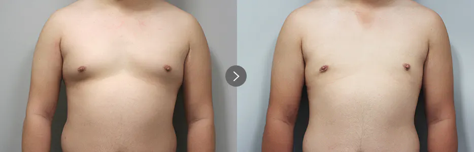 BEFORE&AFTER 4