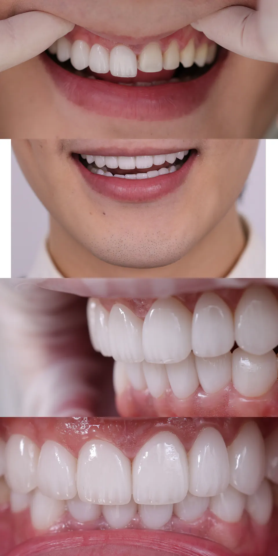 BEFORE&AFTER 12