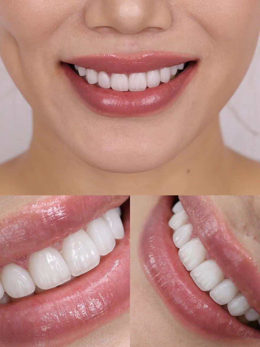 BEFORE&AFTER 7