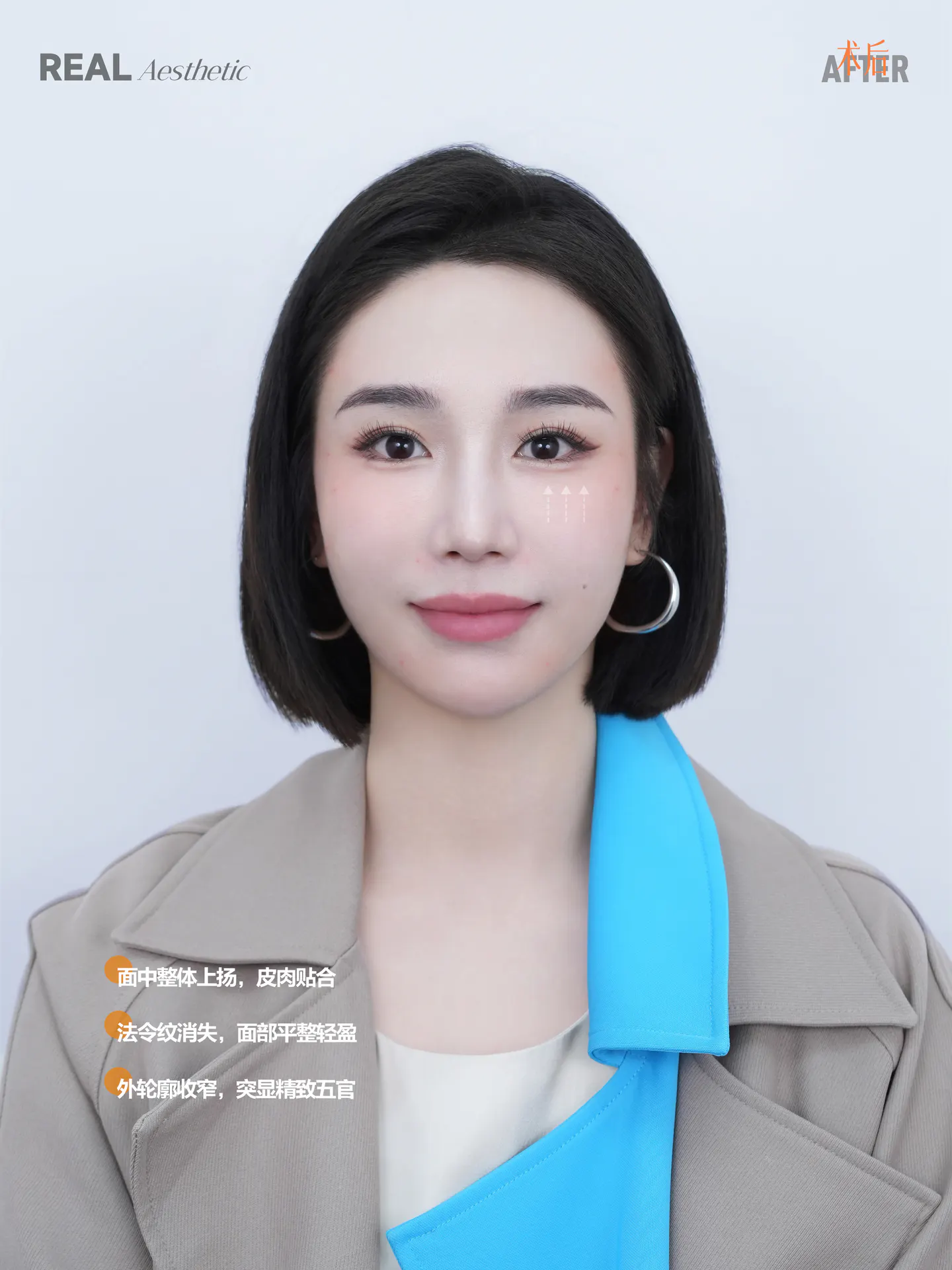 整体美容 1
